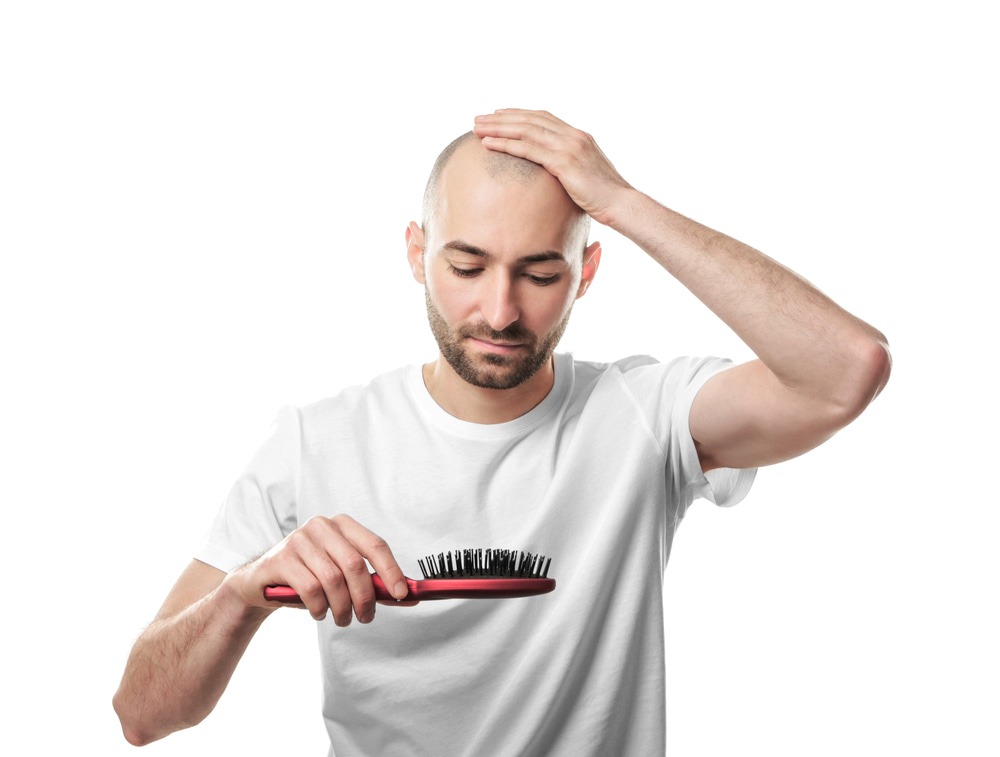 Men’s concerns about genetic baldness.