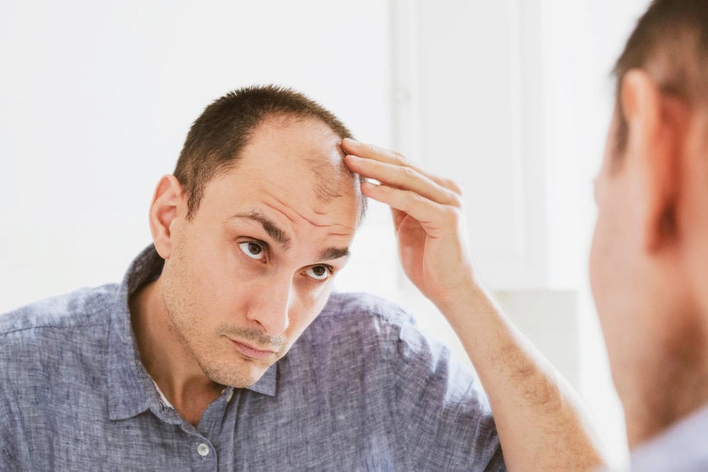 Man looking at himself in the mirror, and contemplating about genetic baldness.