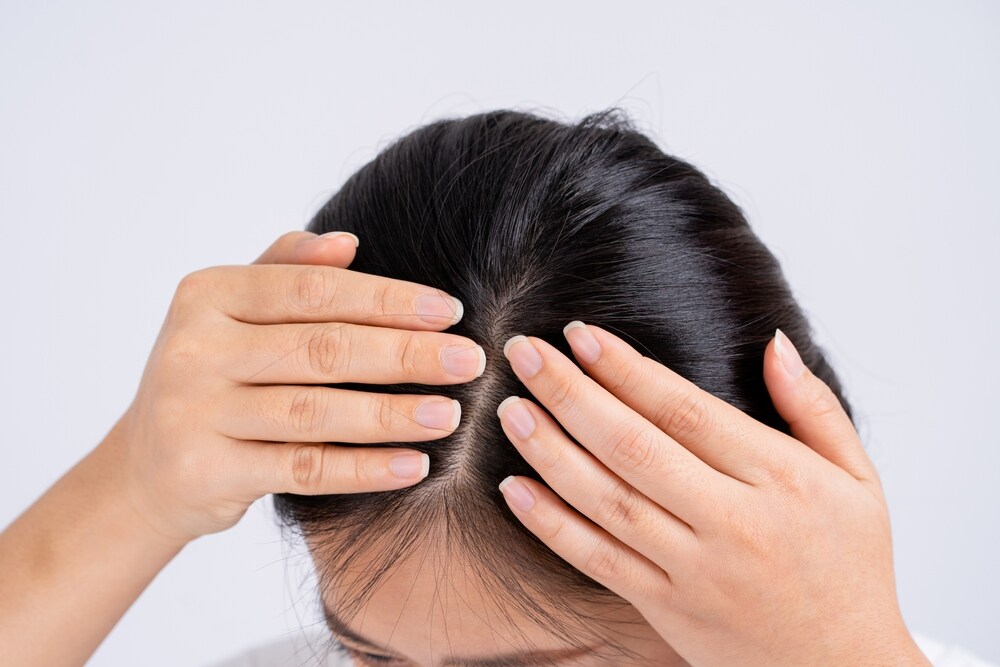 Frequent hair dyeing causes hair loss