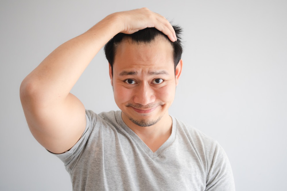 Causes of hair loss according to medical evidence